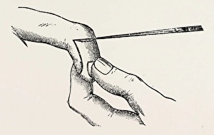 four inches long, a fine key, the mode of holding, medical equipment, surgical instrument four inches long, a fine key, the mode of holding, medical equipment, surgical instrument