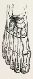 lisfrancs amputation, medical equipment, surgical instrument, history of medicine lisfrancs amputation, medical equipment, surgical instrument, history of medicine