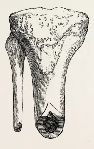 method of sawing, medical equipment, surgical instrument, history of medicine method of sawing, medical equipment, surgical instrument, history of medicine