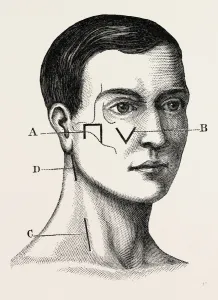 a neurotomy of third division, medical equipment, surgical instrument, history of a neurotomy of third division, medical equipment, surgical instrument, history of