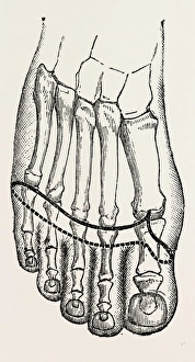 operation, medical equipment, surgical instrument, history of medicine operation, medical equipment, surgical instrument, history of medicine