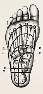plantar incisions, medical equipment, surgical instrument, history of medicine plantar incisions, medical equipment, surgical instrument, history of medicine