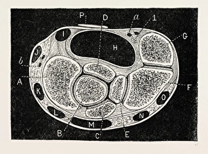 section through, medical equipment, surgical instrument, history of medicine section through, medical equipment, surgical instrument, history of medicine