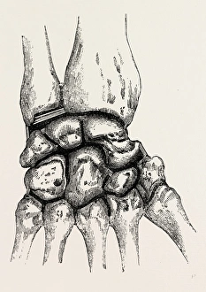 the synovial cavities, medical equipment, surgical instrument, history of medicine the synovial cavities, medical equipment, surgical instrument, history of medicine