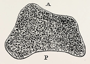 transverse section, medical equipment, surgical instrument, history of medicine transverse section, medical equipment, surgical instrument, history of medicine