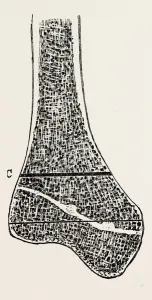 vertical, medical equipment, surgical instrument, history of medicine vertical, medical equipment, surgical instrument, history of medicine