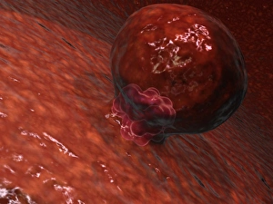 A blastocyst begins implanting in the wall of the uterus A blastocyst begins implanting in the wall of the uterus