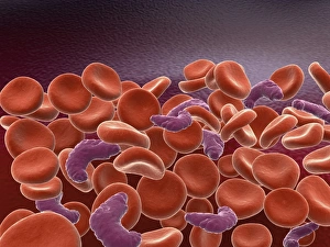 Conceptual image of sickle cell anemia with red blood cells Conceptual image of sickle cell anemia with red blood cells