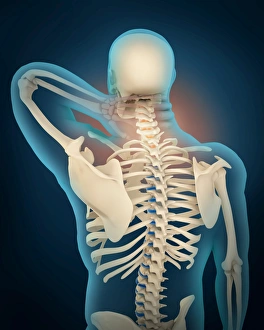 Medical illustration showing inflammation in human neck area Medical illustration showing inflammation in human neck area