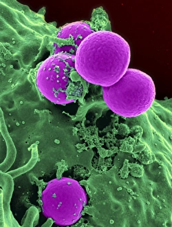 Prints of Scanning electron micrograph of a human neutrophil ingesting MRSA Aureus Prints: Scanning Electron Micrograph Print of Neutrophil Ingesting MRSA Bacteria