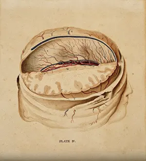 Human Brain Cross Section Prints: Brain: dissection showing a section of the right hemisphere