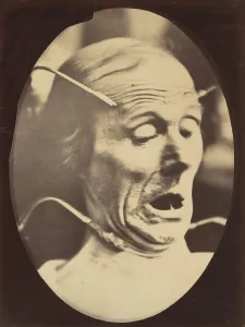 Nineteenth Century French Art Prints: Figure 62: Terror, semiprofile, 1854-56, printed 1862. Creators: Duchenne de Boulogne