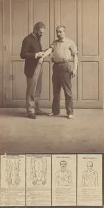 Alphonse Bertillon Notation of Scars Print, 1893