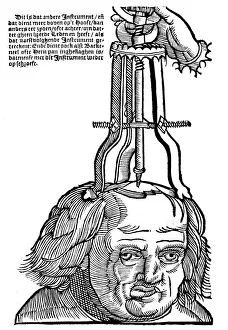 Print of Trephination, 1593