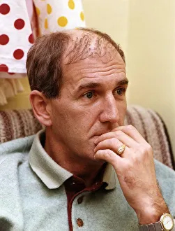 Russ Abbot in a theatre dressing room shows his Hair Transplant A©Mirrorpix Russ Abbot in a theatre dressing room shows his Hair Transplant A©Mirrorpix
