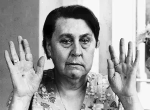 Stigmata sufferer Ethel Chapman shows her palms bearing the marks of the wounds of Stigmata sufferer Ethel Chapman shows her palms bearing the marks of the wounds of