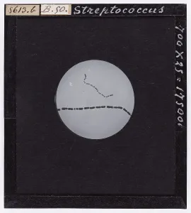 Streptococcus: bacteria enlarged under a microscope