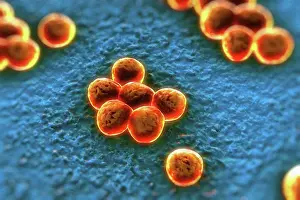 MRSA Bacteria Prints: Clusters of superbug (MRSA) bacteria