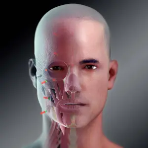Biomedical Illustration Prints: Facial Reconstruction