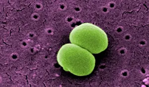 Scanning Electron Microscopic Print of Staphylococcus epidermidis Bacteria