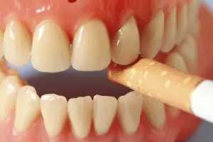 Smoking Addiction Prints: Artificial dentures with cigarette