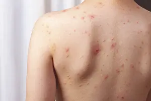 Medical Examination Process Prints: A child stands with their back facing the camera