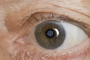 Coronavirus Pandemic Prints: A coronavirus reflected in one eye