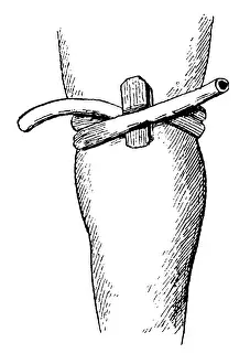 Hygienic Practices Prints: Elastic constriction of the thigh