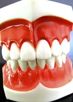 Dental Prosthesis Prints: False teeth