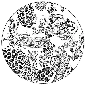 European Healthcare System Image Prints: Ground coffee mixed with chicory