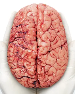 Human Brain Print - Anatomical Illustration