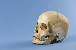 Human Skull Anatomy Prints: Human skull