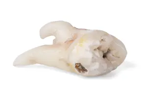 Carious Tooth Prints: Pulled wisdom tooth, tooth, carious