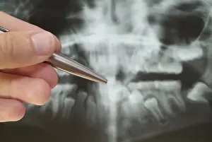 Medical Consultation Prints: Radiograph