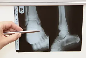 Family Doctor Consultation Prints: Radiograph