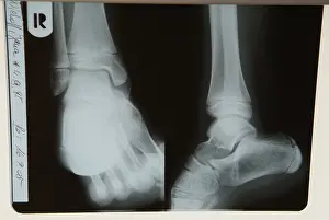 Family Doctor Consultation Prints: Radiograph