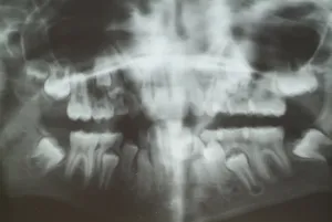 Medical Consultation Prints: Radiograph