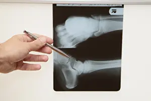 Family Doctor Consultation Prints: Radiograph