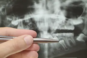 Medical Consultation Prints: Radiograph