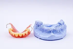 Dentist Treatment Prints: Removable denture of an upper jaw