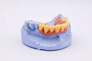 Upper Jaw Denture Prints: Removable denture of an upper jaw