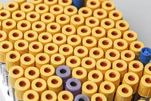 Scientific Research Tools Prints: Set of Test tubes in the laboratory