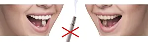 Healthy Smile Prints: Smile before and after smoking