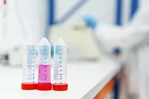 Healthcare Professionals At Work Prints: Three tubes with samples in the table of a laboratory with someone working on the background
