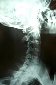 X-ray X-ray Print: Medical Diagnostic Image