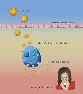 Pollen Allergy Symptoms Prints: Allergic Response, Illustration