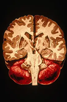 Human Brain Anatomy Prints: Brain, Coronal Section