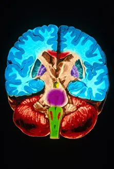 Cerebral Cortex Illustration Prints: Brain, Coronal Section