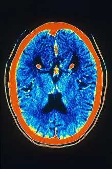 Human Brain Anatomy Prints: Brain, CT Scan