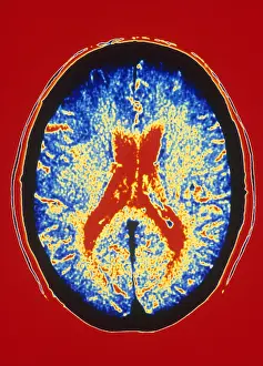 Human Brain Anatomy Prints: Brain, CT Scan